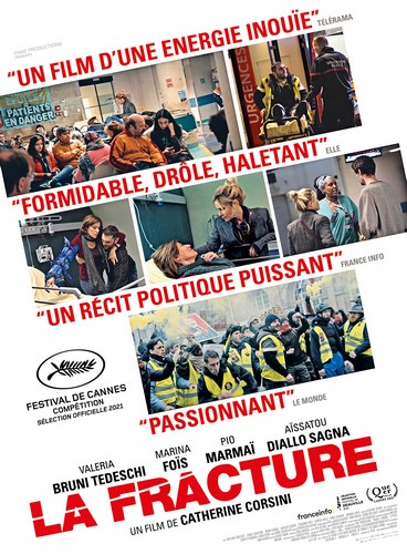 La fracture FRENCH HDTS MD 2021